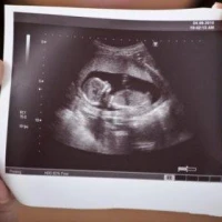 Нові види УЗД