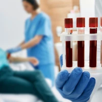 Аутоімунні захворювання: що це таке, чому виникають і як з ними боротися?