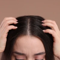 Що викликає себорею і як її позбутись