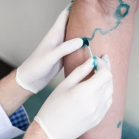 Важливі питання про варикоз: що робити для профілактики і як вибрати лікаря?