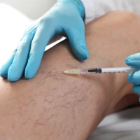 Як назавжди позбутися варикозу? Ендовенозна лазерна коагуляція!