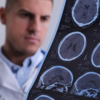 Така різна хвороба. 10 міфів про епілепсію