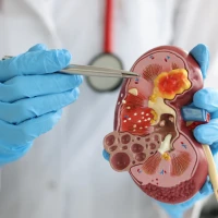 Як зрозуміти, що болять нирки: 9 симптомів, які не можна упускати