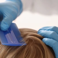 Все, що ви хотіли знати про педикульоз, але боялись запитати