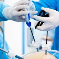 ЛАПАРОСКОПІЧНА ХОЛЕЦИСТЕКТОМІЯ В ОКСФОРД МЕДІКАЛ!