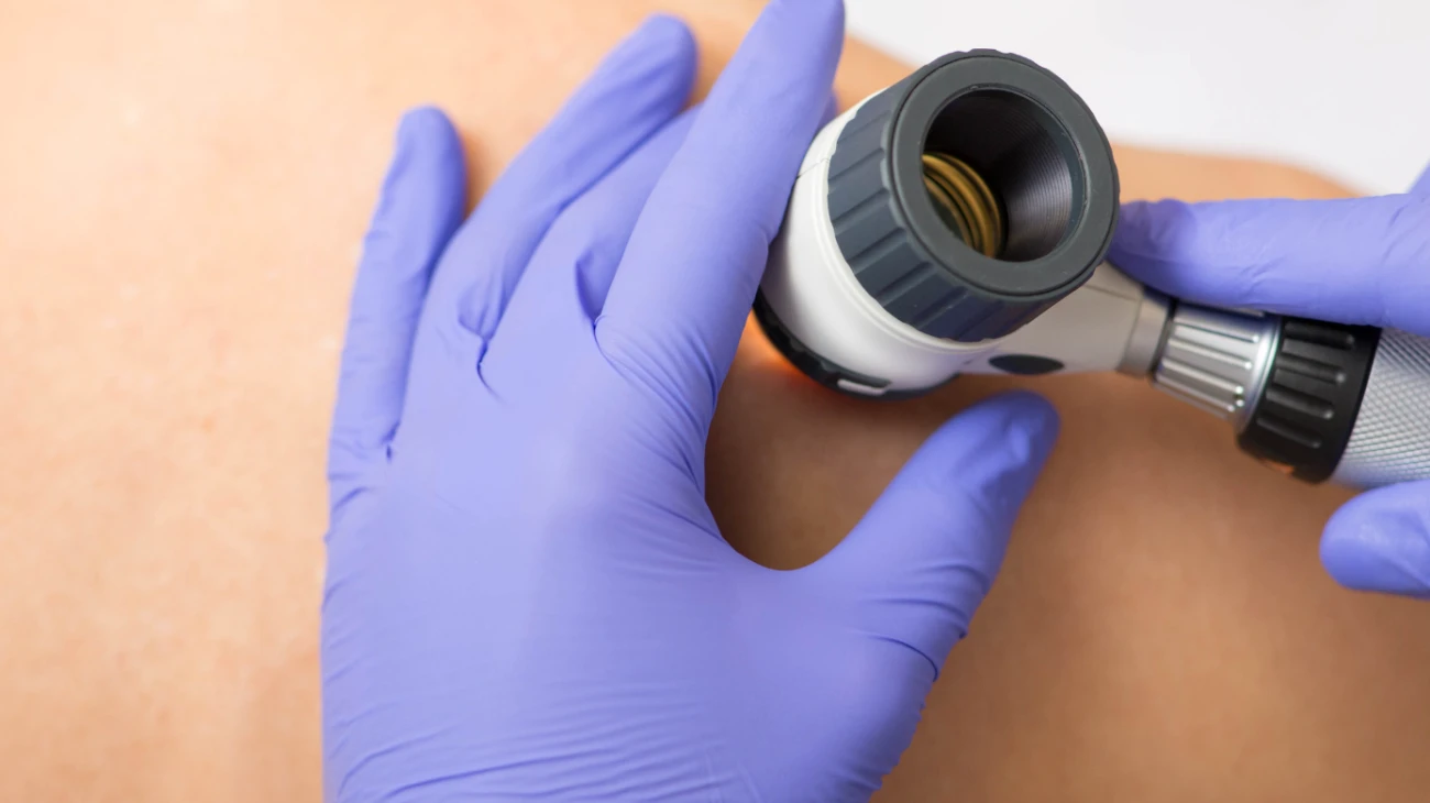 Відділення дерматології: комплексні програми