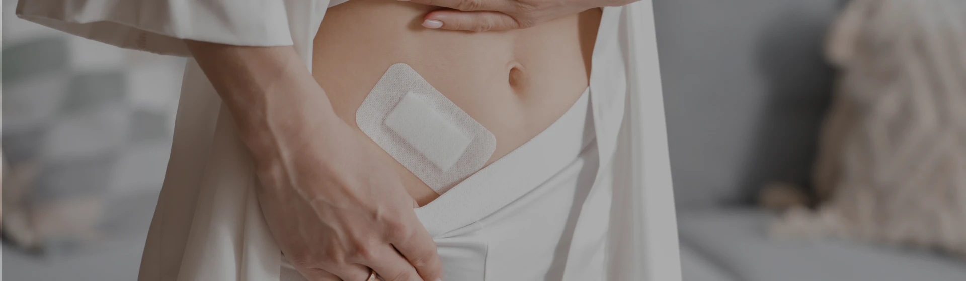 Апендектомія