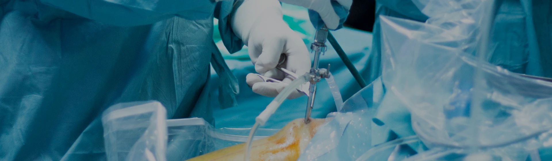 Ендопротезування кульшових і колінних суглобів