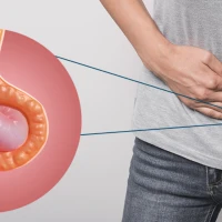 ЛАПАРОСКОПІЧНЕ ВИДАЛЕННЯ ПАХОВИХ ГРИЖ В ОКСФОРД МЕДІКАЛ ТЕРНОПІЛЬ